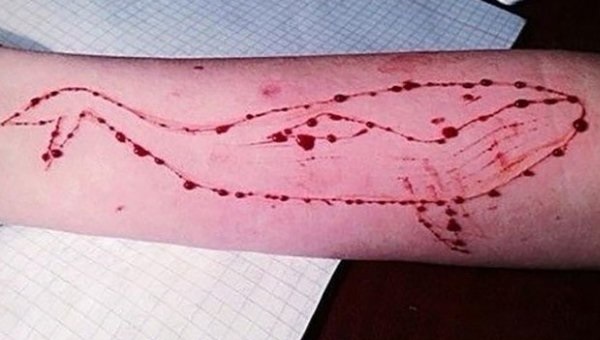 САМОРУЙНІВНА ПОВЕДІНКА У ПІДЛІТКІВ